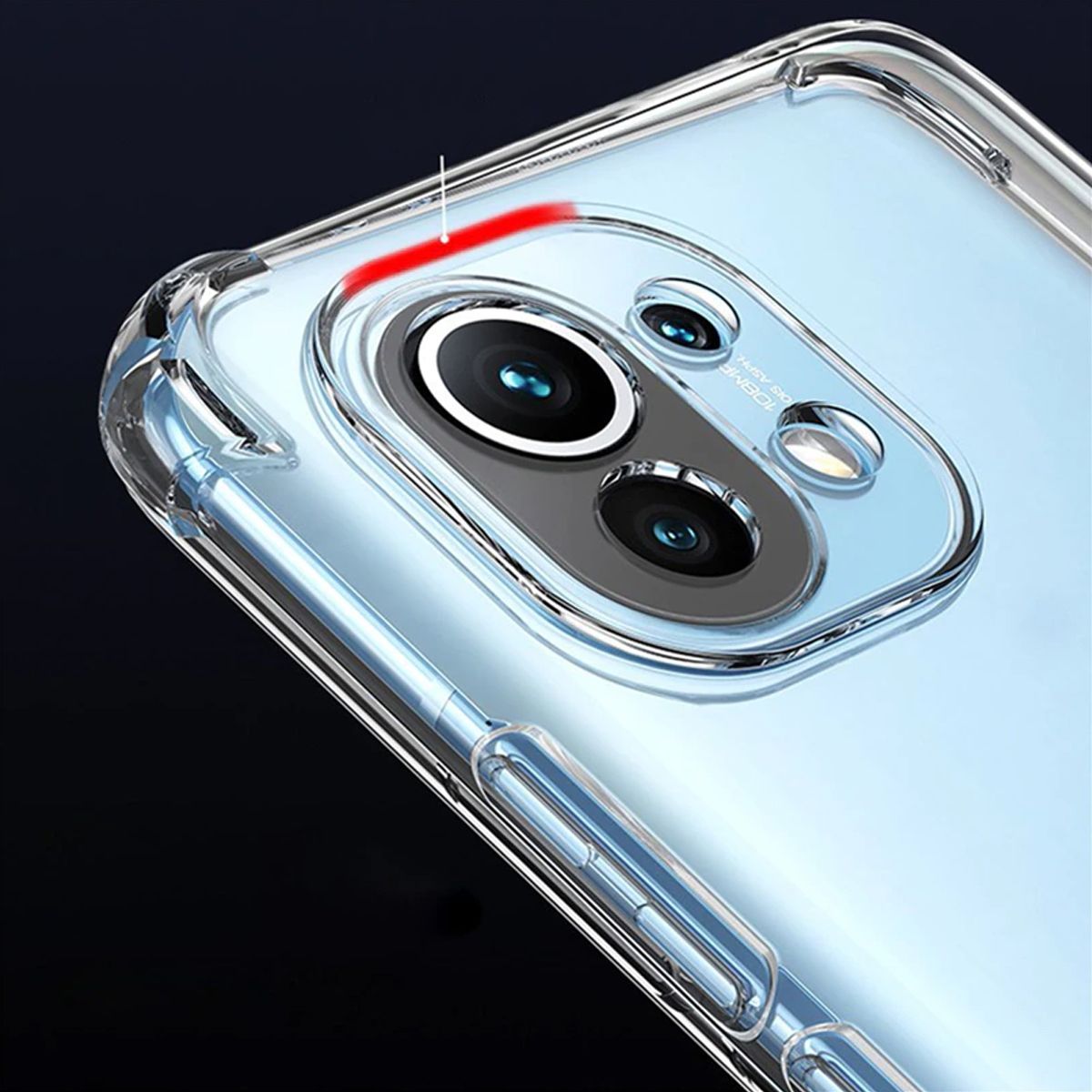 Stöttåligt Mobilskal Xiaomi Mi 11 - Transparent